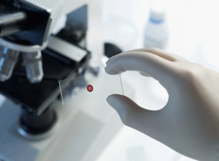 Laboratory tests