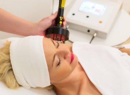 LASER TREATMENTS