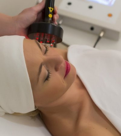 CW Laser korekce vrásek kyselinou hyaluronovou po vrstvách 60 '(jedna vrstva), 90' (dvě vrstvy)